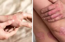 Petites imperfections sur le cou
